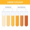 Urine color chart illustration of dehydration level