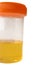 Urine sample