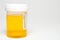 Urine Sample