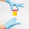 Urine sample analysis in jar in hands gloves by a doctor or a bio lab worker. Urology and kidney diseases and urinary tract