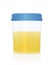 Urine Sample Specimen Cup Medical Examination Urological Checkup