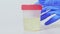 Urine test clinical diagnostics hand bottle set 3