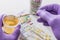 Urine test strips in purple gloves