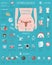 Uterine fibroids. Ginecological medical desease in women infographic