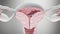 uterus malignant tumor, Female uterus anatomy, Reproductive system, cancer cells, ovaries cysts, gynecological disease