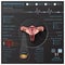 Uterus And Ovary Anatomy System Medical Infographic Infochart