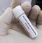 Vaginal fluid sample for Cervical Cancer Screening (CO-Testing),