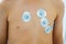 Valencia, Spain - July 17, 2019: Electrodes placed on the chest of a child to perform an electrocardiogram in a hospital