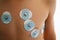 Valencia, Spain - July 17, 2019: To study the pulse and heart health of a child, the doctor places adhesive electrodes on the