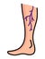 Varicose treatment icon. Violation of circulatory system. Vascular disease diagnostic. Venous insufficiency medical