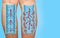 Varicose veins on a female senior legs. The structure of normal and varicose veins.