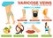 Varicose veins symptoms and preventions poster with info vector