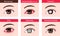 Various eye diseases vector illustration  female eye