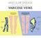 Vascular diseases. Varicose veins symptoms, treatment icon set.