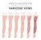 Vascular diseases. Varicose veins symptoms, treatment icon set.