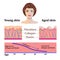 Vector faces and two types of skin - aged and young for medical and cosmetological illustrations isolated
