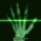 Vector green abstract hand tomography analysis illustration. Palm x-ray scan. Medical data MRI visualization concept.