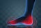 vector human foot. blue contour and red spots of pain. ready element for medicine and orthopedics