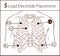 Vector illustration of a 5 lead electrode placement