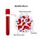 Vector illustration with blood cells and medical tube.