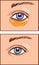 Vector illustration of a eye aesthetic blepharoplasty