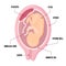Vector infographic with fetus of womb and placenta. anatomy diagram illustration with umbilical cord and cervix.