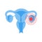 Vector isolated illustration of uterus with pain