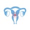 Vector isolated illustration of uterus with pain