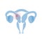 Vector isolated illustration of uterus with pain