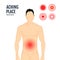Vector pain target hurt red circle. Pain marker on body