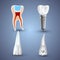 Vector set of 3d realistic clean and dirty tooth isolated on gray background. Dental health Concept. Oral Care, teeth