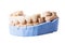 Veneers and crowns isolated on white background. Plaster model of teeth. lower jaw plaster model with prepared teeth