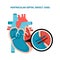 Ventricular septal defect VSD. Human heart muscle diseases cross-section. Cardiology concept.