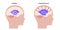 Ventricular system concept