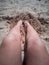 Vertical image of burned legs on the beach sand. aftermath of summer