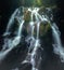 Vertical shot of a beautiful flowing cascade waterfall
