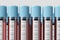 Vertical test tubes with blood