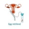 Vertor illustration for specialized manuals. Oocyte retrieval. Egg donation. Donor. Extracorporeal fertilization. Flat