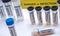 Vials of samples with positive results from patients infected with covid-19 coronavirus in a laboratory