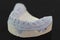 View of plaster model of lower front teeth
