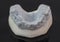 View of plaster model of lower front teeth