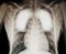 Virus destroys human lungs the lnflamed radiograph