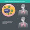 Virus spread destroyed to lungs, Illustration show different the lungs human from CORONAVIRUSES