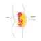 Visceral fat diagram