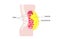 Visceral fat diagram