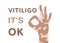 Vitiligo poster. Human hand and text. Vitiligo it`s ok. Color flat illustration of body positive, self love. Isolated vector imag