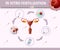 In Vitro Fertilization Colored Poster with Uterus