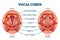 Vocal cords labeled anatomical and medical structure and location scheme