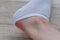 Water corns on heels of a woman in white socks, RUB the calluses with new shoes. grated bloody blown callus on the foot on skin.