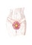 Watercolor Woman in white panties with red flower in bikini zone, close-up. Gynecology, menstruation, the concept of